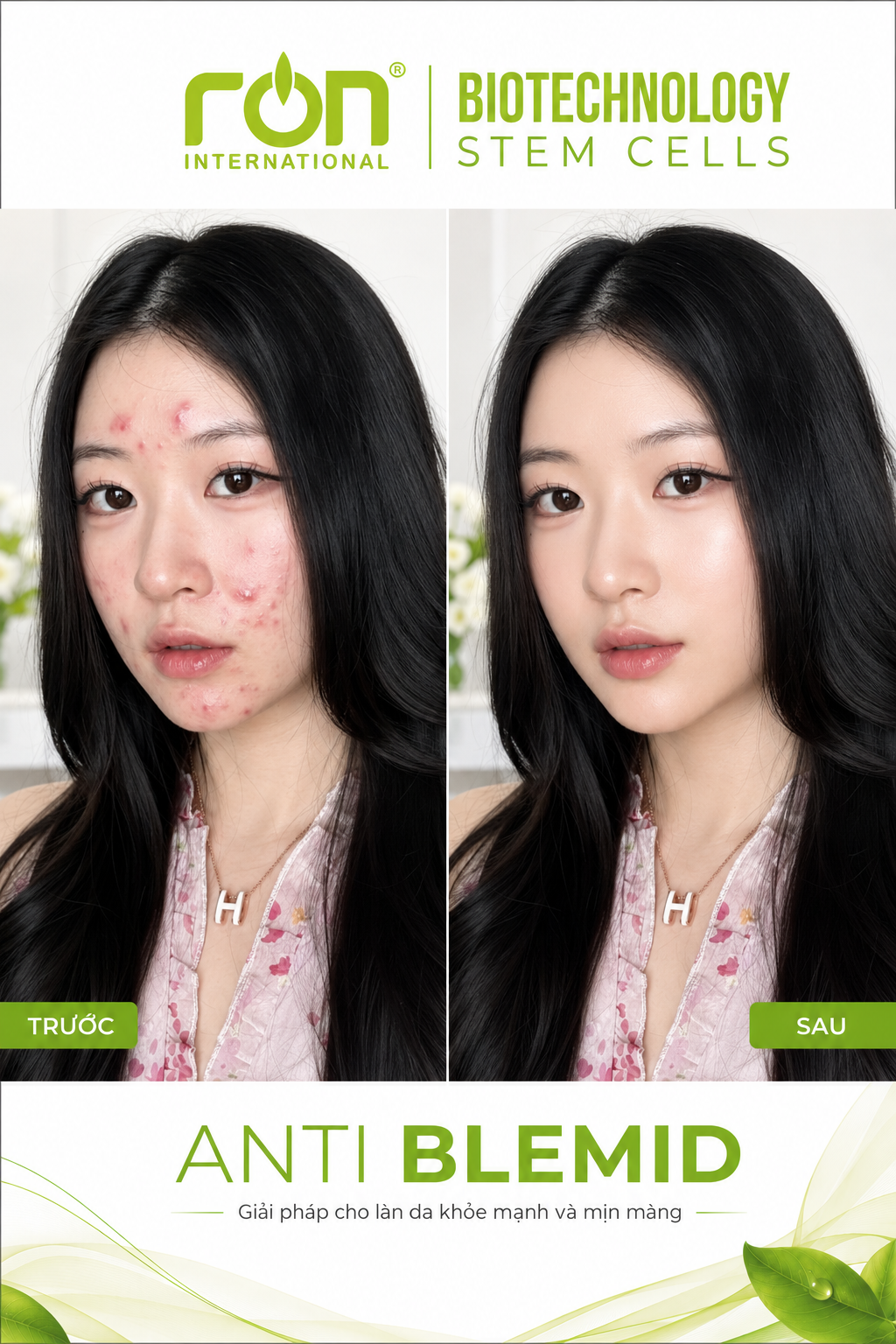TINH CHẤT TÁI TẠO PHỤC HỒI DÀNH CHO DA MỤN DR. BEFACE ANTI BLEMID ACNE