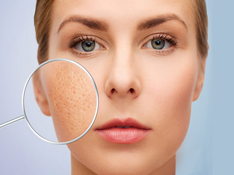 cách làm se khít lỗ chân lông ở mặt