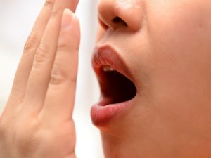 Gợi ý những cách chữa nhiệt miệng đơn giản tại nhà
