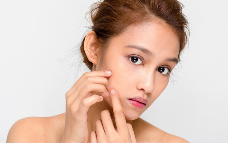 những lưu ý khi chăm sóc da dầu