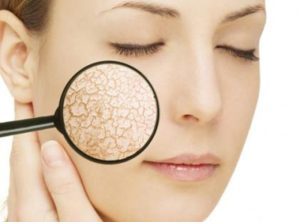 Cách chăm sóc da khô luôn mềm mại và căng tràn sức sống