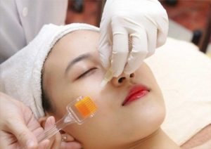 Các bước chăm sóc bằng tế bào gốc dùng sau lăn kim