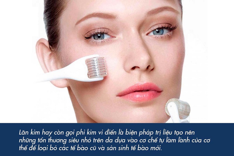 Tế bào gốc