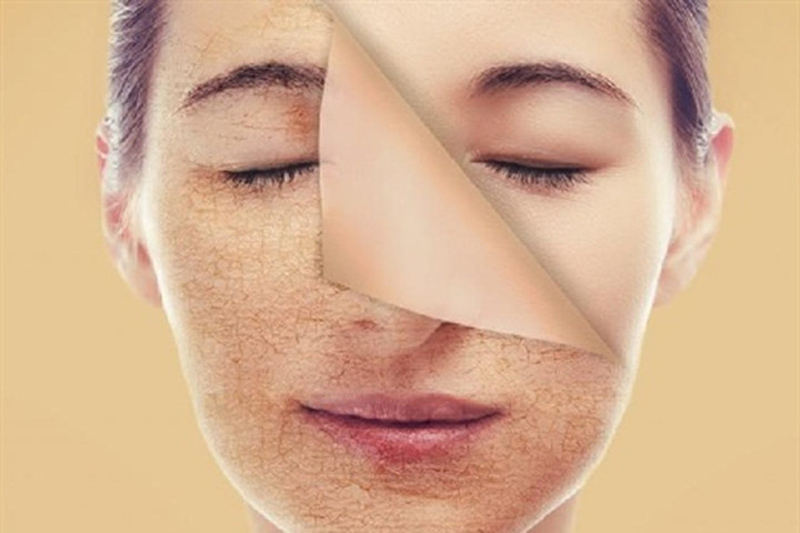 tẩy tế bào chết có tác dụng gì
