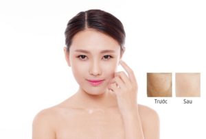 Tăng tế bào gốc nội sinh – Giải pháp ngăn ngừa lão hóa da hiệu quả