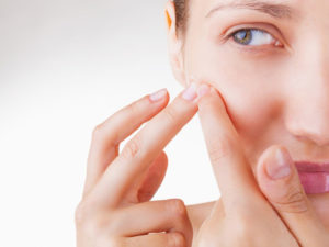 Tìm hiểu nguyên nhân và cách trị mụn đầu trắng tại nhà