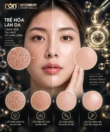 Hình minh họa texture bề mặt da và lỗ chân lông trông ít rõ hơn; không phải kết quả thử nghiệm BFS12